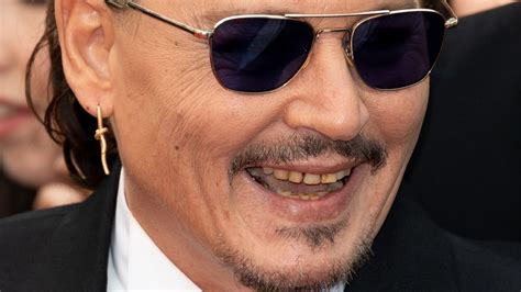 What Happened To Johnny Depp's Teeth?