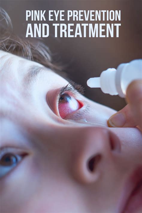 Pink Eye Prevention and Treatment — Thrifty Mommas Tips