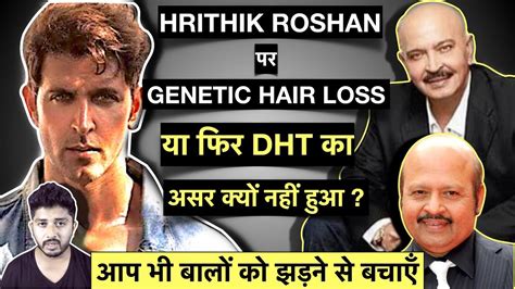 Hrithik Roshan क्यों गंजे नहीं हुए? How to Stop Genetic Hair Fall or DHT like Hrithik Roshan ...