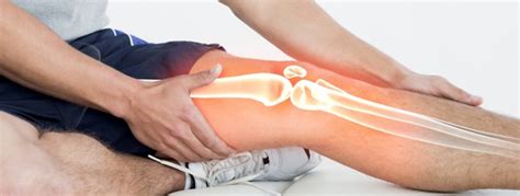 What are the symptoms of knee ligament injuries? - New Mexico Orthopaedic Associates