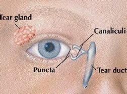 Nasolacrimal Duct Obstruction – A2Z Facts