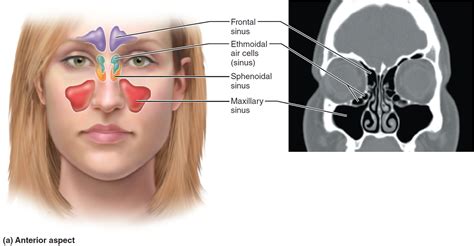 Sinus Infection - Causes, Symptoms, Diagnosis, Treatment & Home Remedies