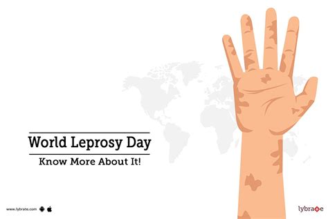 World Leprosy Day - Know More About It! - By Dr. Sanjeev Kumar Singh ...