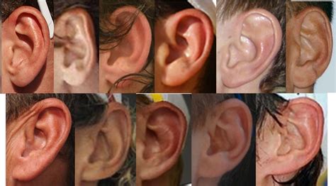 Punnett's Square: Attached Earlobes: The Myth