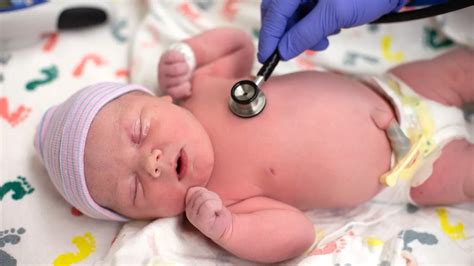 The Lifesaving Impact of Delayed Umbilical Cord Clamping on Premature Babies