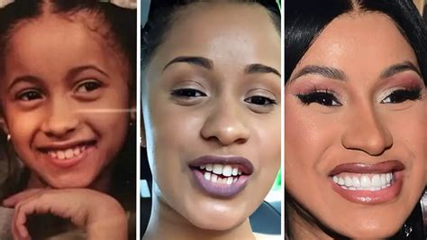 Did Cardi B Have Braces Or Invisalign - Cardi B's Dental Work Secrets ...