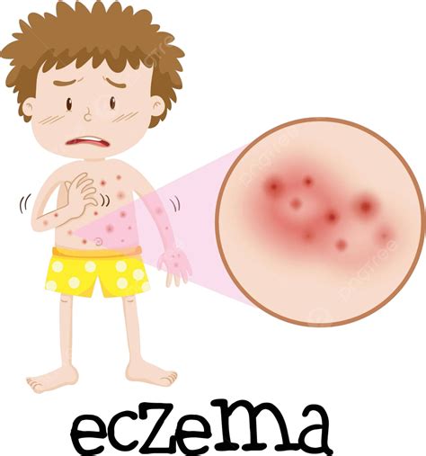 Young Boy With Magnified Eczema Doctor Drawing Clinic Vector, Doctor, Drawing, Clinic PNG and ...