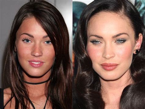 Megan Fox, Before and After | Megan fox plastic surgery, Celebrity ...