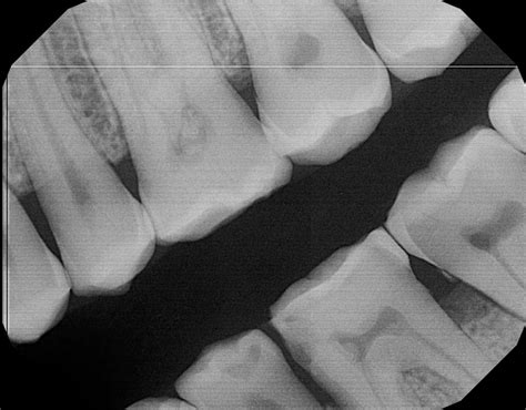 X-ray Sensor Calibration File Installation and Retrieval For Your Dental Sensor