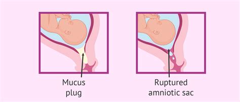 Mucus plug and water breaking