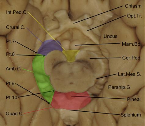 Basal Cisterns Anatomy