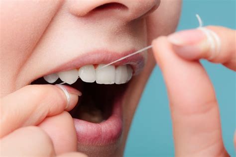 Proper Flossing Techniques - Family Dentist in Rockledge, FL