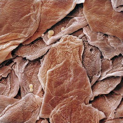 Human Skin Cells (SEM) - Stock Image - C015/0762 - Science Photo Library