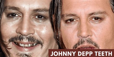 What Happened to Johnny Depp's Teeth to Make Them Appear So Bad ...