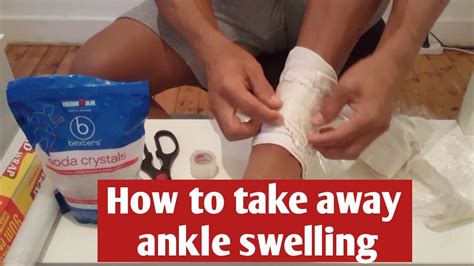 How to use Soda Crystals to reduce ankle swelling - YouTube