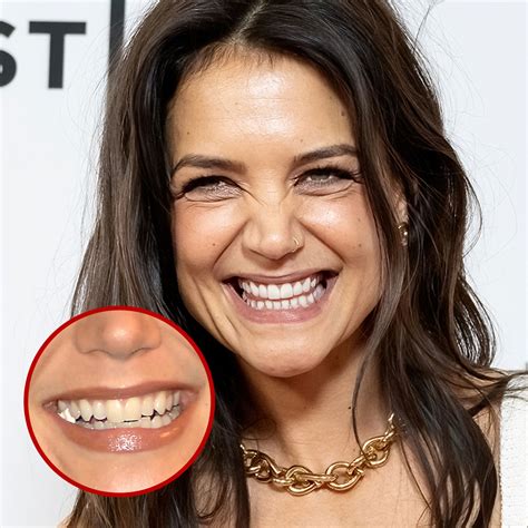 21 Celebrity Dental Implants And Veneers: Before And After - SHEfinds