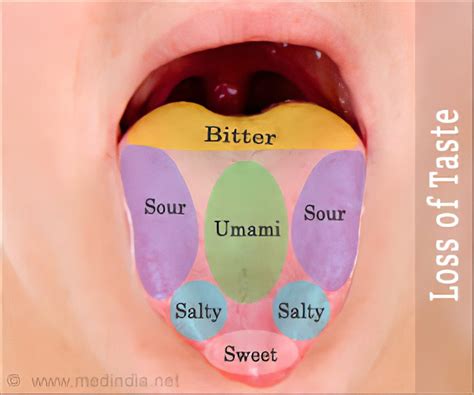 Bell's Palsy Taste Buds - mapasgmaes