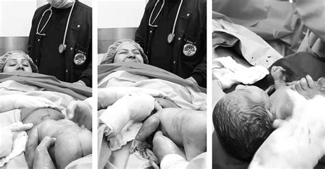 Must watch: Amazing c-section breech birth video captures bottom-first birth