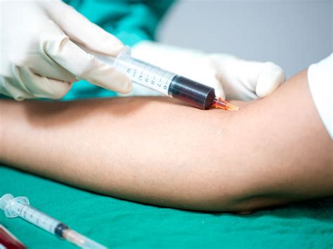 Blood infection: Causes, Symptoms, Risk Factors, Diagnosis and Treatment - Scope Heal