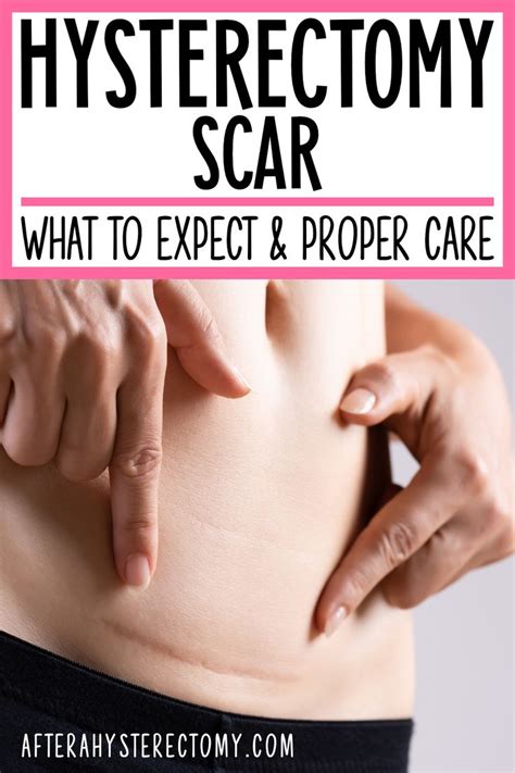 Hysterectomy Scar: What to Expect & Proper Care - After A Hysterectomy ...