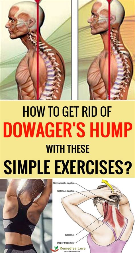 dowagers-hump-simple-exercises