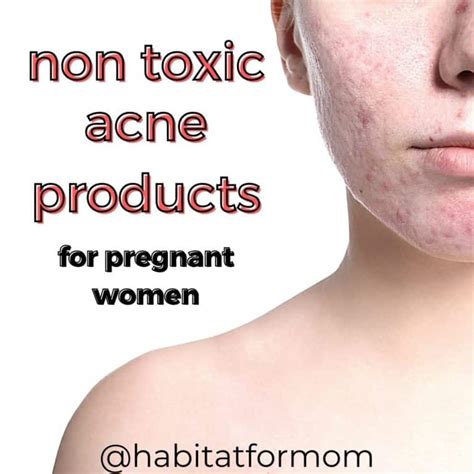 8 Best Pregnancy Skin Care Products for Acne – Habitat for Mom