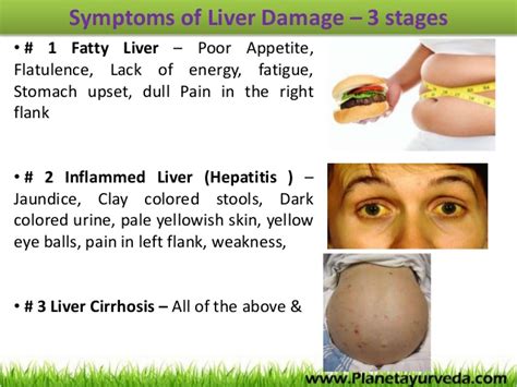 Liver Pain Causes | MedicineBTG.com