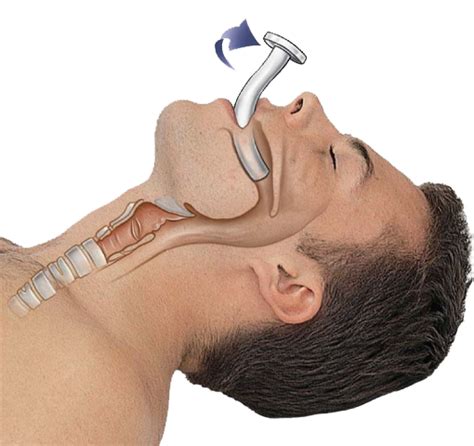 Oropharyngeal Airway Measurement