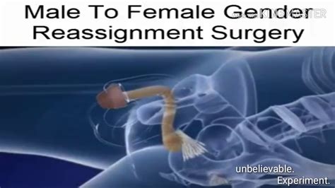 Male To Female Gender Reassignment Surgery - YouTube