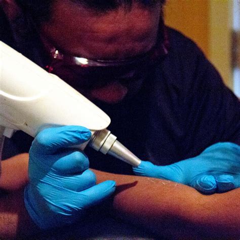 Removing Gang Tattoos ‘A Life And Death Thing’ | WBEZ Chicago