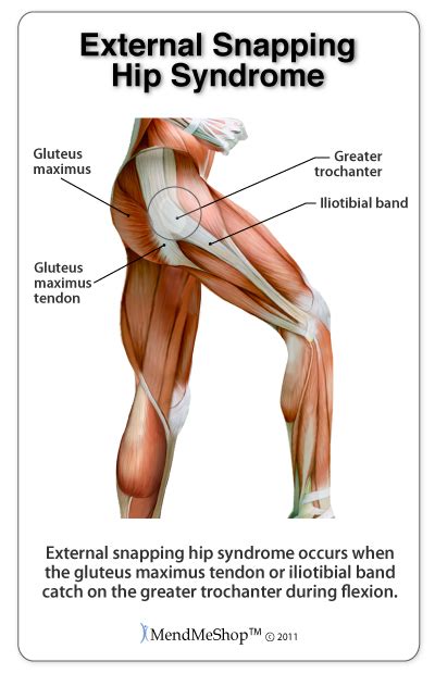 Tendons Of The Hip