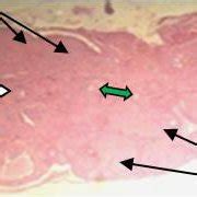Section in ovary of treated rat with PGB (300mg/kg b.wt/ day) after 3... | Download Scientific ...