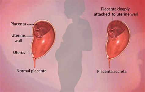 Health Condition : Symptoms, Causes, Treatment and More