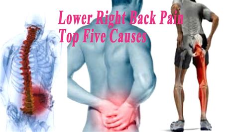 Lower Right Back Pain – Top Five Causes of Lower Back Pain Right Side - YouTube