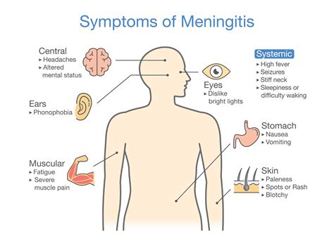 Rigors And Chills - Symptoms, Causes, & Best Home Remedies