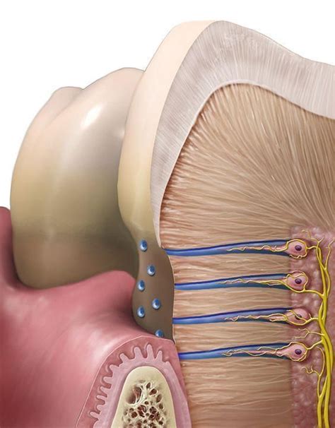 Sensibilidad dental