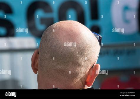 man with a bald head, hair growth and hair loss in aging male people ...