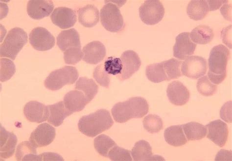 Free picture: blood smear, old, immature, schizont, plasmodium malariae