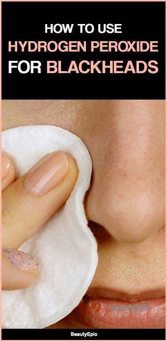 How to Use Hydrogen Peroxide to Remove Blackheads? | Natural skin care, Blackheads, Natural cold ...