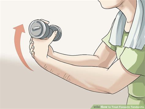 3 Ways to Treat Forearm Tendonitis - wikiHow