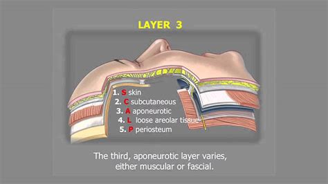 What is SMAS Face lifting?? and Who needs Face lifting? - Центр Пластической Хирургии JW