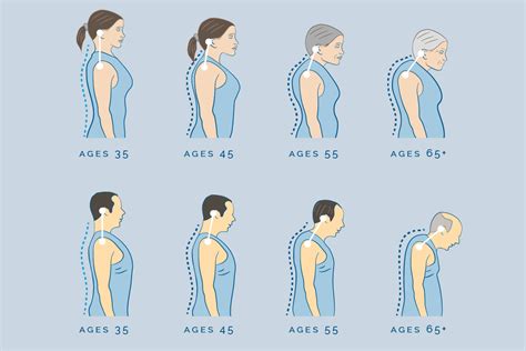 spinal-curvature-aging-process - Rehab Concepts