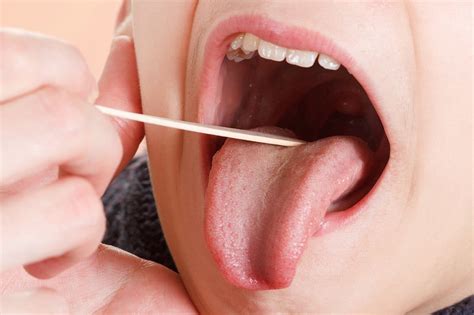Discover 73+ can tonsillitis cause ringing ears super hot - vova.edu.vn