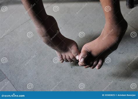 Twisted legs stock image. Image of american, enforcement - 35583825