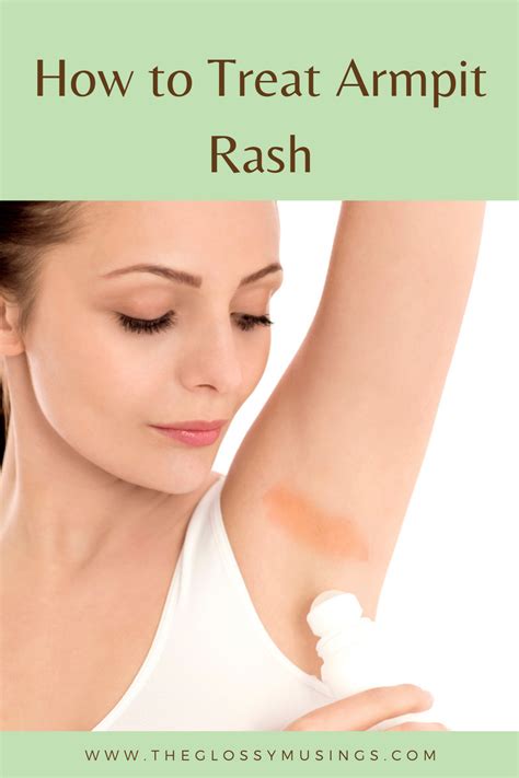 How to Get Rid of Armpit Rash | Armpit rash, Underarm rash, Types of skin rashes