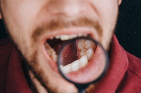Risk Factors for Oral Cancer - Safe Harbor Dental Chesapeake Virginia