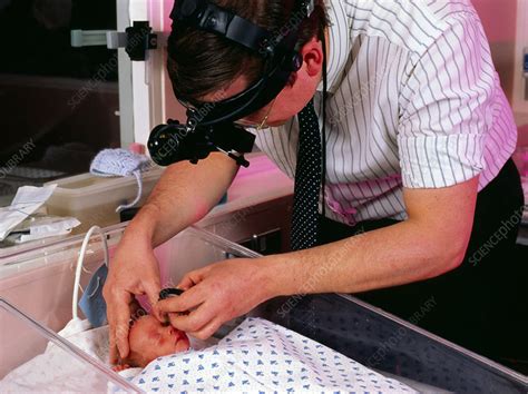 Ophthalmoscopic exam of premature baby's eyes - Stock Image - M820/0120 ...