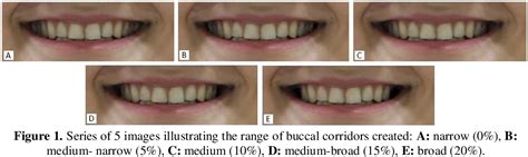 Figure 1 from The Effects of Buccal Corridors on Smile Esthetics in Dentists and Orthodontic ...