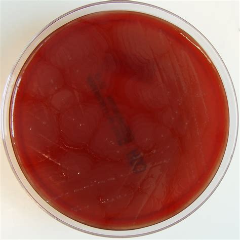 Proteus Mirabilis On Blood Agar