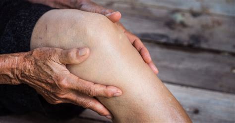 Natural Remedies for Osteoarthritis | Wildwood Lifestyle Center